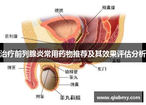 治疗前列腺炎常用药物推荐及其效果评估分析